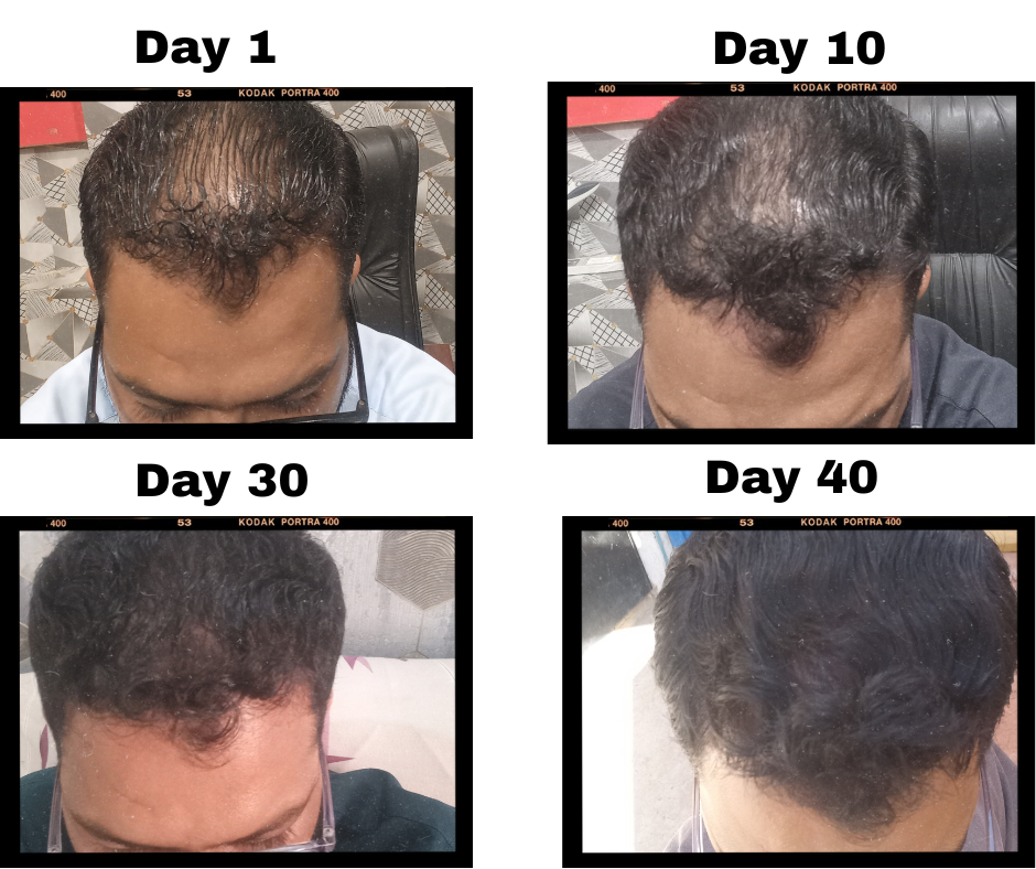 HIBA HERBAL HAIR OIL